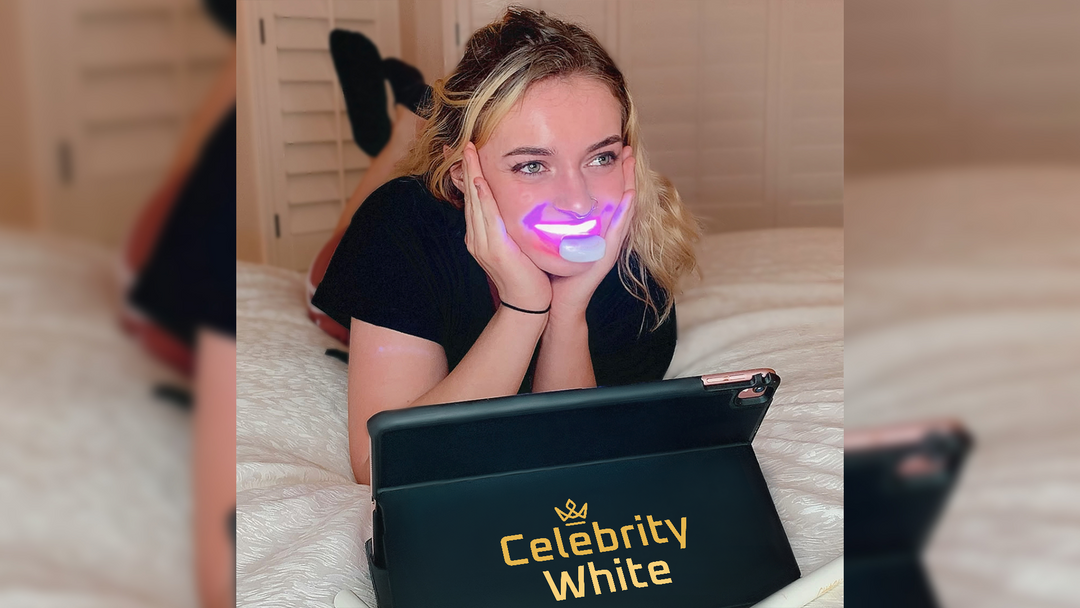 CELEBRITY WHITE WHITENING PENS (Limited Time)